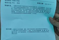 乔治韧带恢复时间(乔治伤势如何)