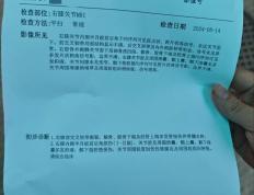 乔治韧带恢复时间(乔治伤势如何)