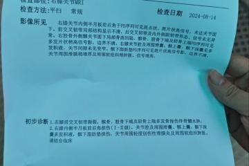 乔治韧带恢复时间(乔治伤势如何)